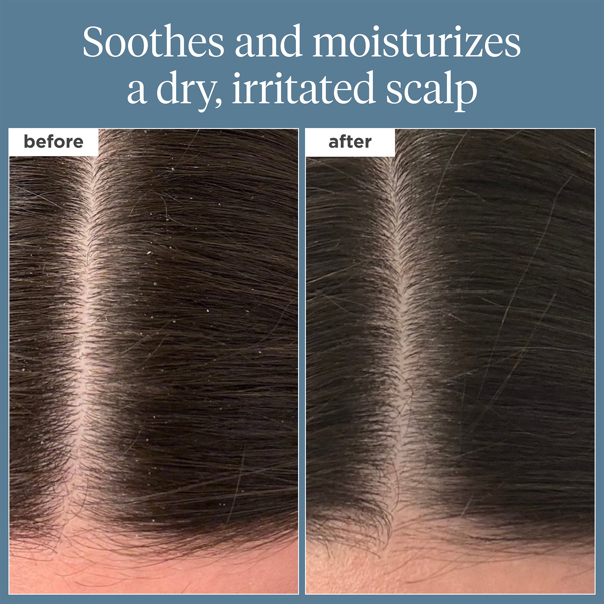 Scalp Revival Rosemary Pre-Wash Oil 1oz - Briogeo