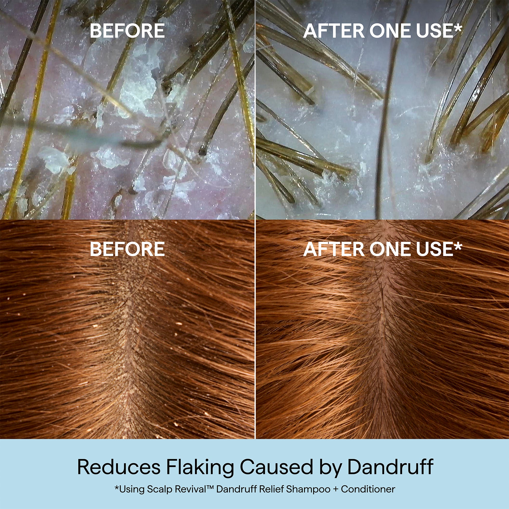 Scalp Revival™ Dandruff Relief Shampoo with Charcoal + 3% Salicylic Acid - Briogeo